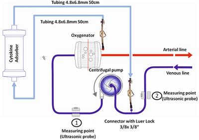 Cytokine Adsorption in Critically Ill Patients Requiring ECMO Support